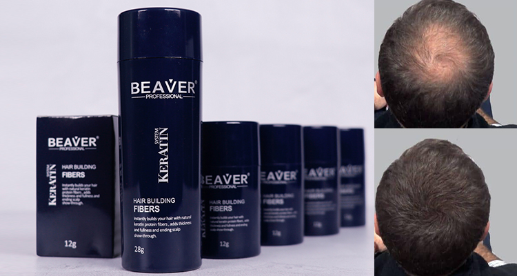 keratin hair fibers